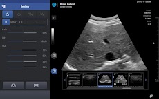 SONON X Ultrasound Appのおすすめ画像3