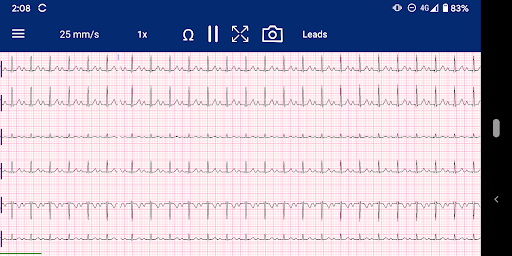 MyRhythm Pro Screen 3