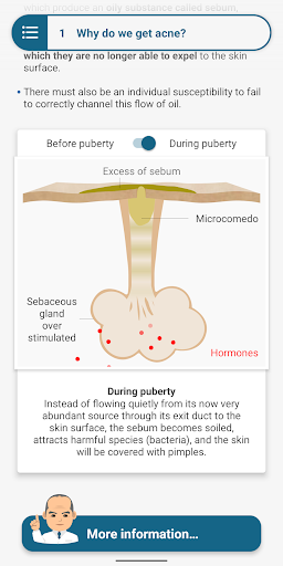Android application 20 Questions on Acne in 2020 screenshort
