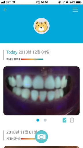 덴티노트 (Dentinote) Screen 2