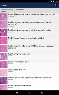 Anatomic Pathology Flashcards Capture d'écran