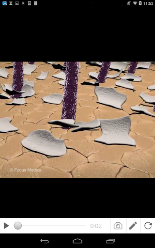 Dandruff Screen 3