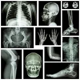musculoskeletal x-ray interpretation GUIDE icon