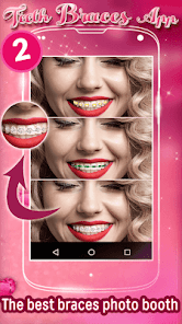 Captura 2 Frenos En Los Dientes Aplicaci android
