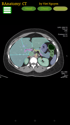 Android application Radiology CT Anatomy screenshort