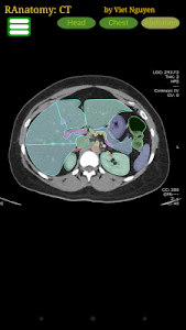 Radiology CT Anatomy Unknown