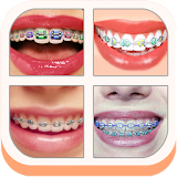 Teeth Braces Sticker Editor icon