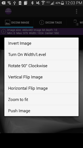 Mobile Dicom Viewer Screen 3