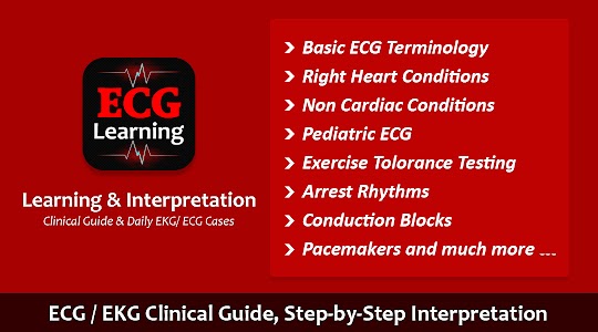 ECG Learning & Interpretation Unknown