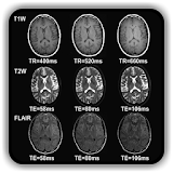Overview of MRI Pulse Sequences icon