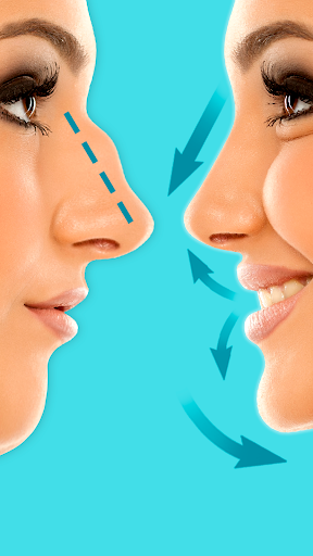 Rhinoplasty: Nose Editor screenshot