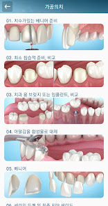 스크린샷 이미지