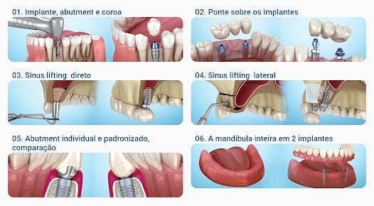 Imagem da captura de tela