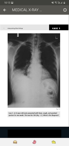 X-RAY Interpretation - cases Screenshot