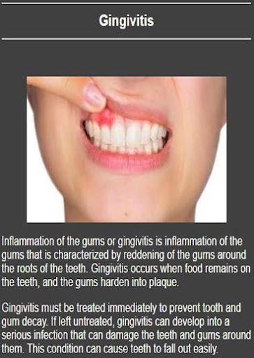 All dental diseases Screen 3