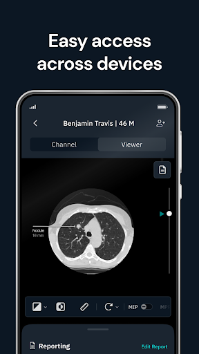 Android application Qure.ai screenshort