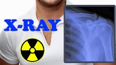 X-Ray Filter Photoのおすすめ画像3
