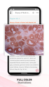 Screenshot 3 Williams Manual of Hematology android