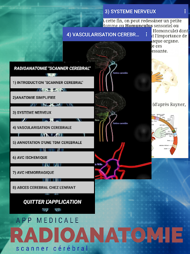 Android application radio-anatomie"scanner cérébra screenshort