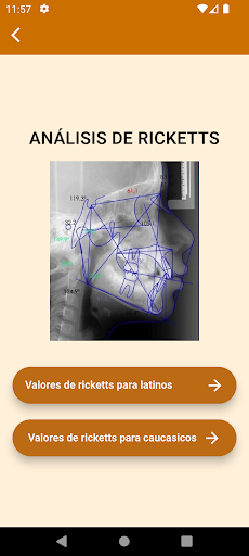 Análisis Ricketts Screen 2