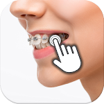 Cover Image of ダウンロード Braces on teeth: Photo editor  APK