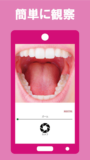 デンタルミラー・カメラ（お口の観察・記録） Screen 2