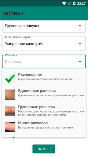 SCORAD - оценка тяжести атопич Screen 2