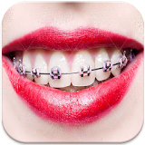 Real Braces Teeth Booth Camera icon