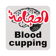 الحجامة - Blood cupping