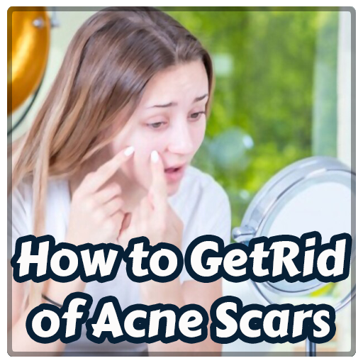 How to Get Rid of Pimple Scars विंडोज़ पर डाउनलोड करें