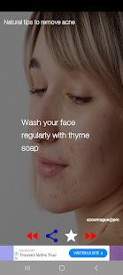 Acne Removal Tips Natural Screenshot