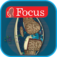 Atlas of Rheumatoid Arthritis