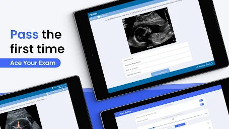 Prepry - ARDMS & CCI Exam Prep - Screenshot Image