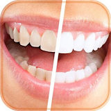 How to whiten your teeth icon