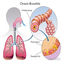 All respiratory disorder