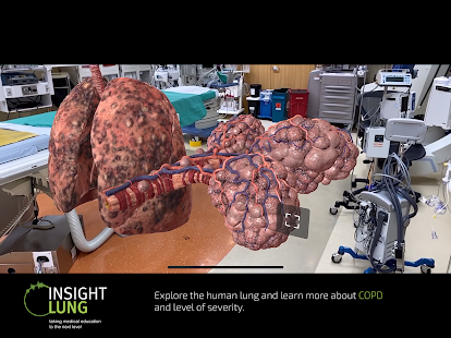 INSIGHT LUNG Screenshot