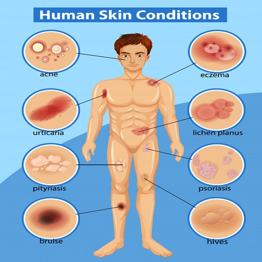 Atlas of All Skin Diseases  Treatments