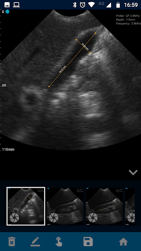 VistaScan Ultrasound App Screen 3