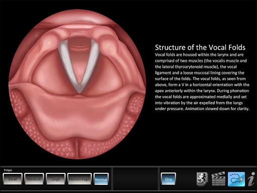 Polyps Screen 2
