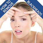 Cover Image of ダウンロード How To Remove Blackheads 7.4 APK