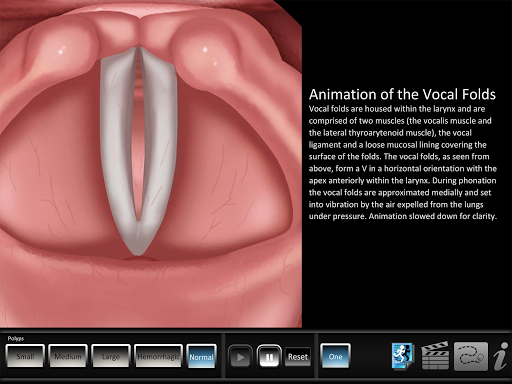 Android application Polyps screenshort