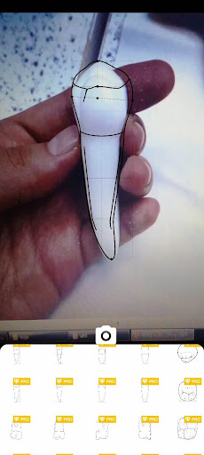 Dentamera ( Dental Anatomy ) Screen 3