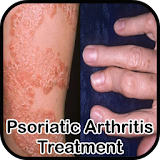 Psoriatic Arthritis Treatment icon