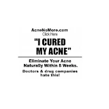 Acne Home Remedies icon