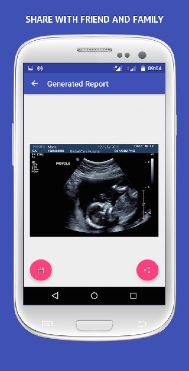 Android application UltraSound Spoof screenshort