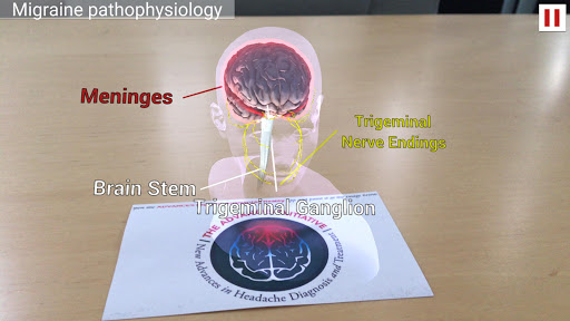 ADVANCES Migraine Augmented Re Screen 3