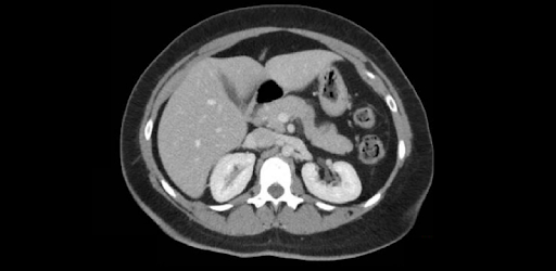 Radiology CT Viewer