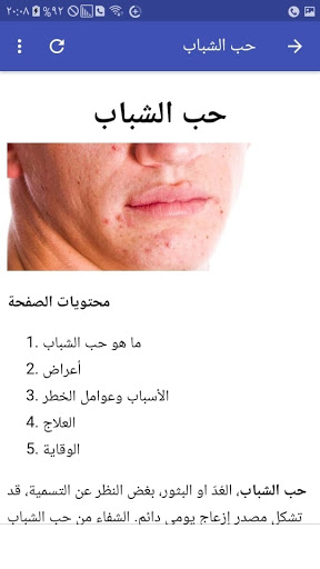Facial acne treatment Screen 3