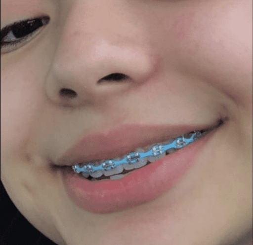 Dental Braces Screen 2