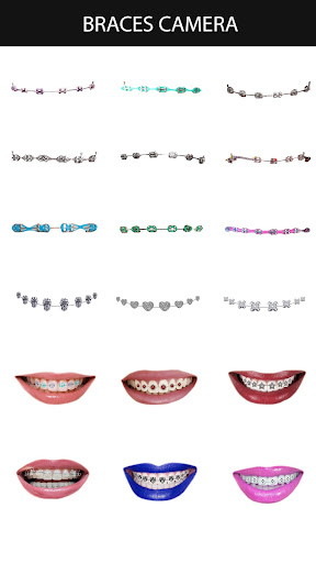 Braces Camera Screen 2